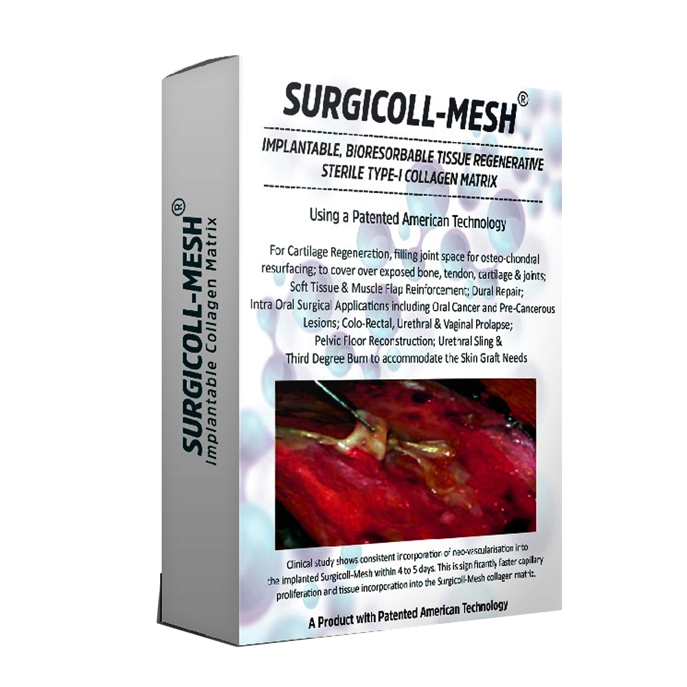 Advanced Biotech Surgicoll Mesh 5x5 (8001.B-01)