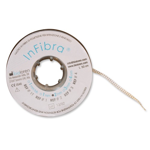 Ammdent Infibra Fiber Splint - 2mm