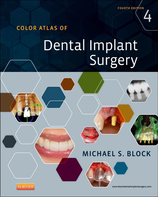 Color Atlas Of Dental Implant Surgery - 4th Edition (ISBN - 759682)