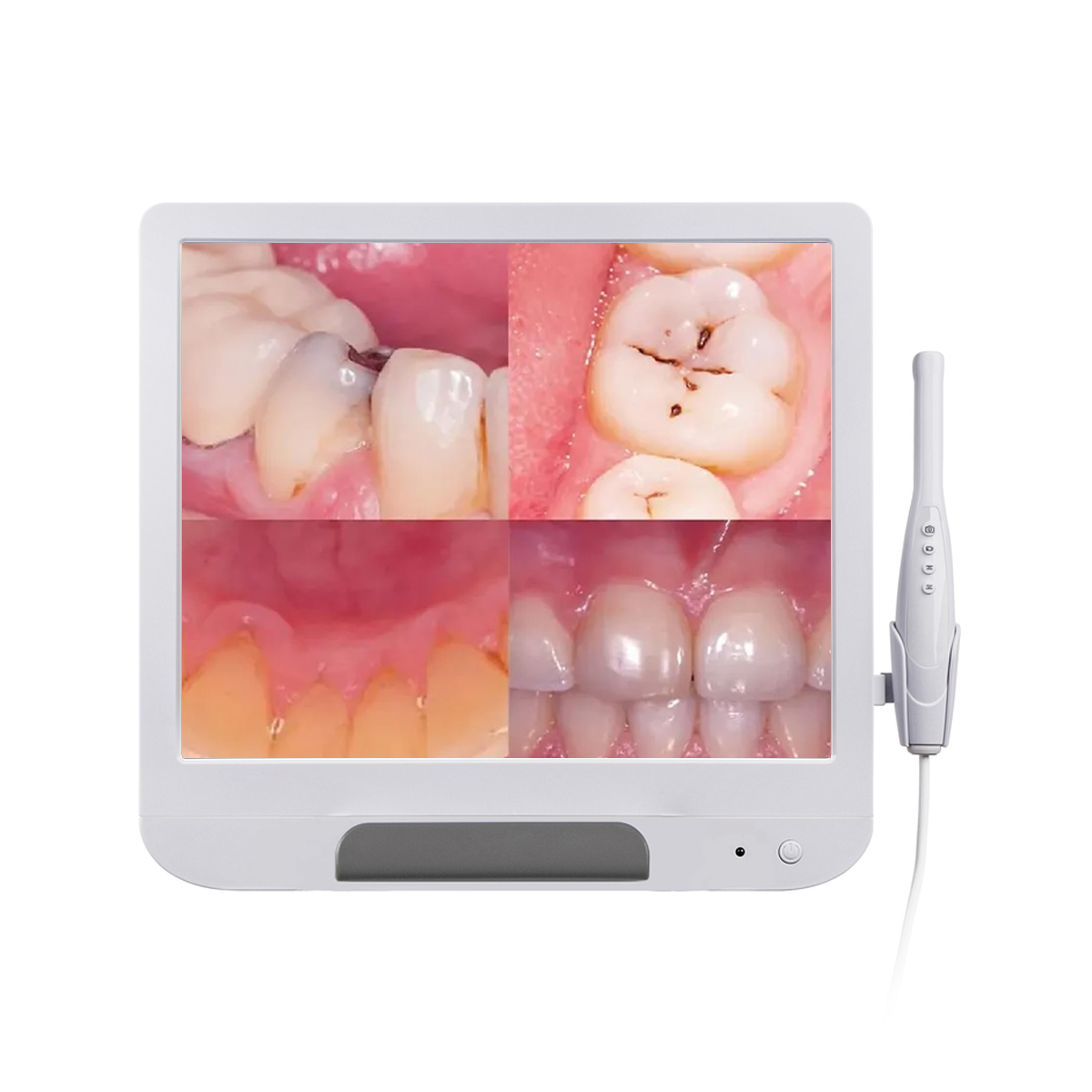 Dental 17-Inch HD Intraoral Camera System with Display (DA-MC04)
