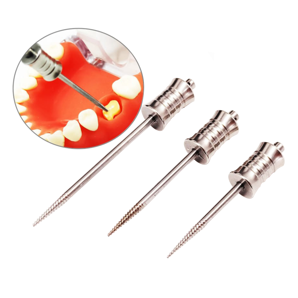 HN Dental Root - Buddy Root Remover System (Pack Of 3)