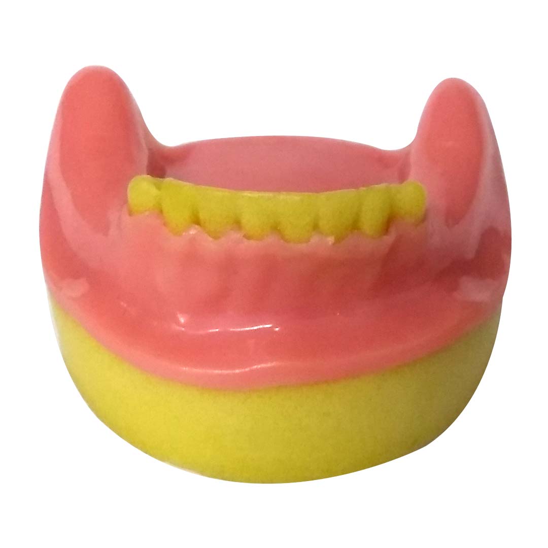 Idental Model Partially Edentulous Mandible MD-123