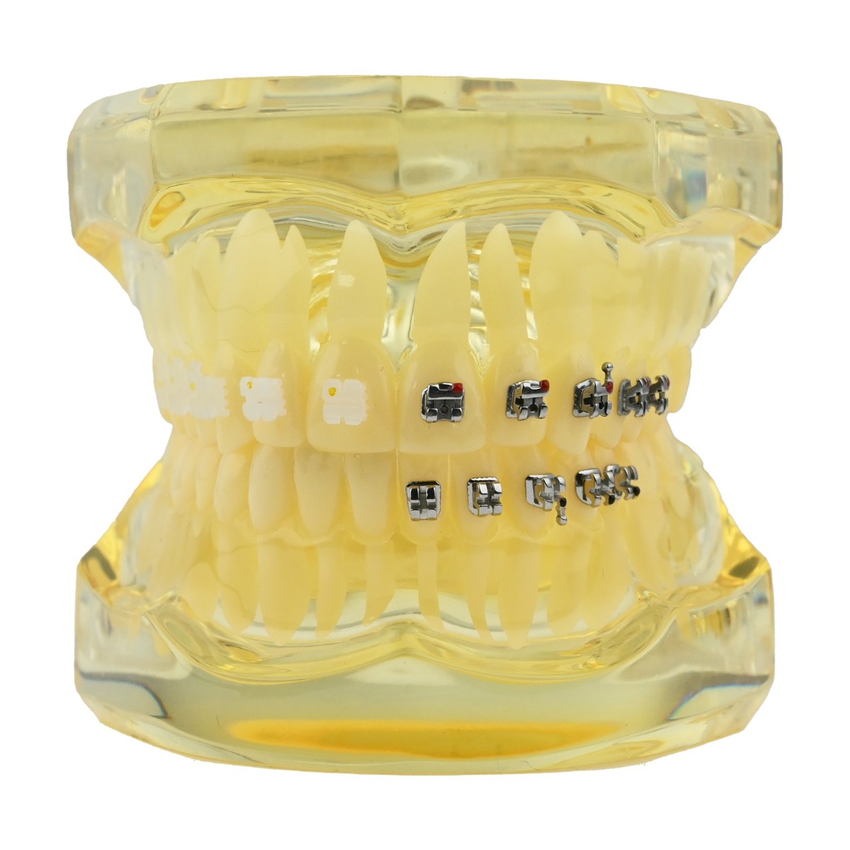 iDENTical Self Ligating Model M3012 Yellow