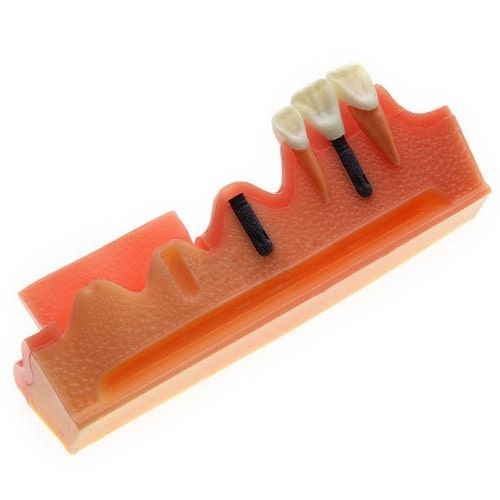 iDENTical Steps for Implant Model M2018