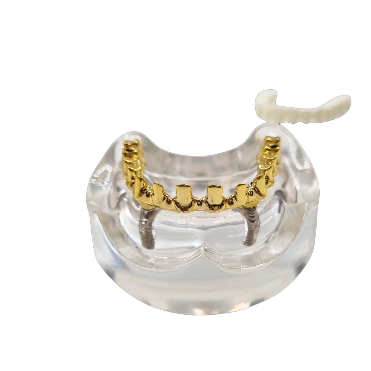 Julldent All On 4 Paulo Malo Model With Prosthesis - Golden