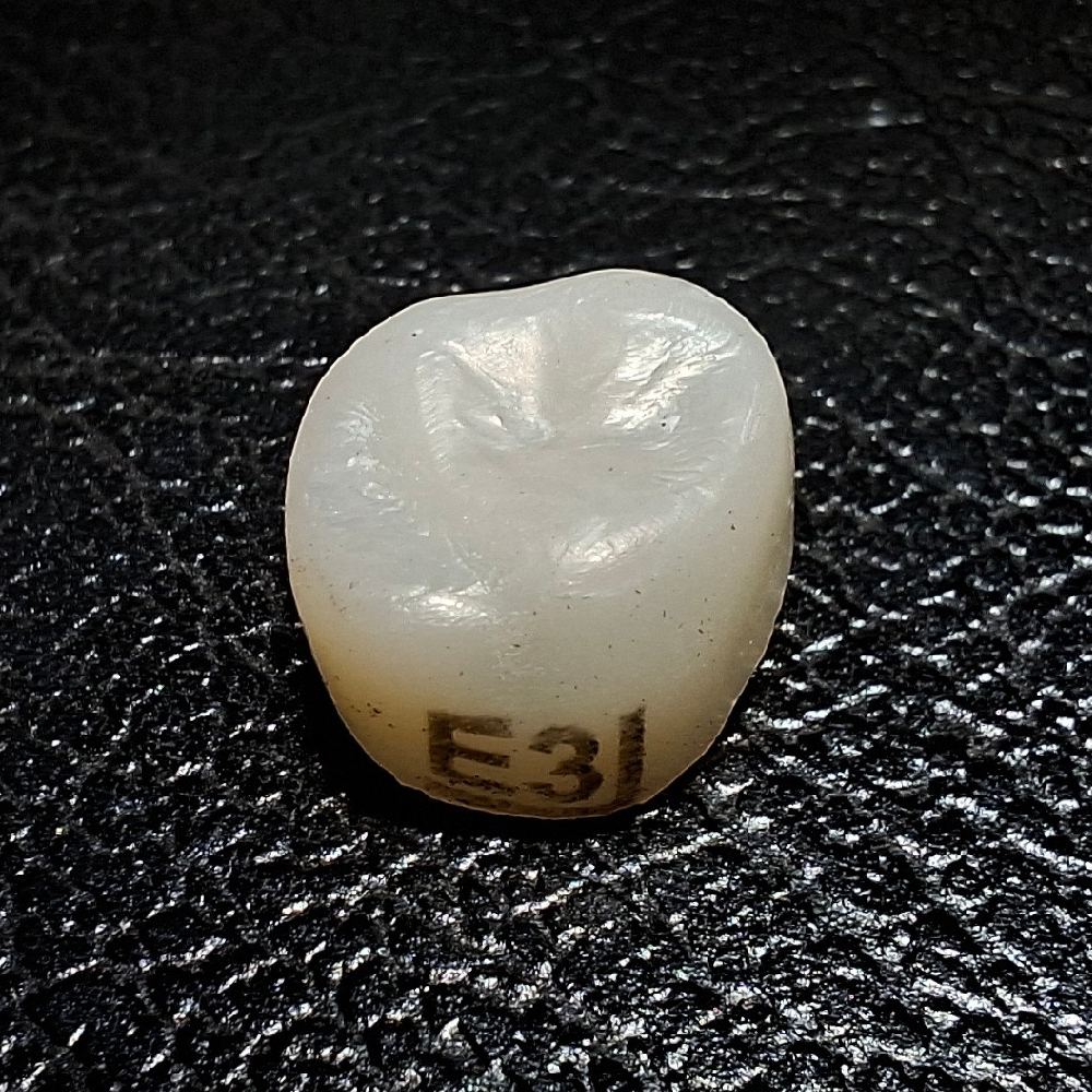 Pedo Crown Primary 2nd Upper Left Molar Refill - Size E3
