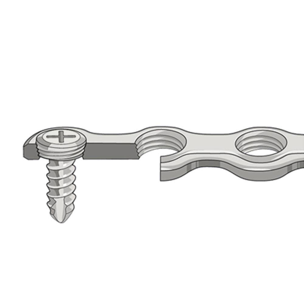 SK Surgicals SS Mini Bone Locking Plates - 2mm (Pack of 2)