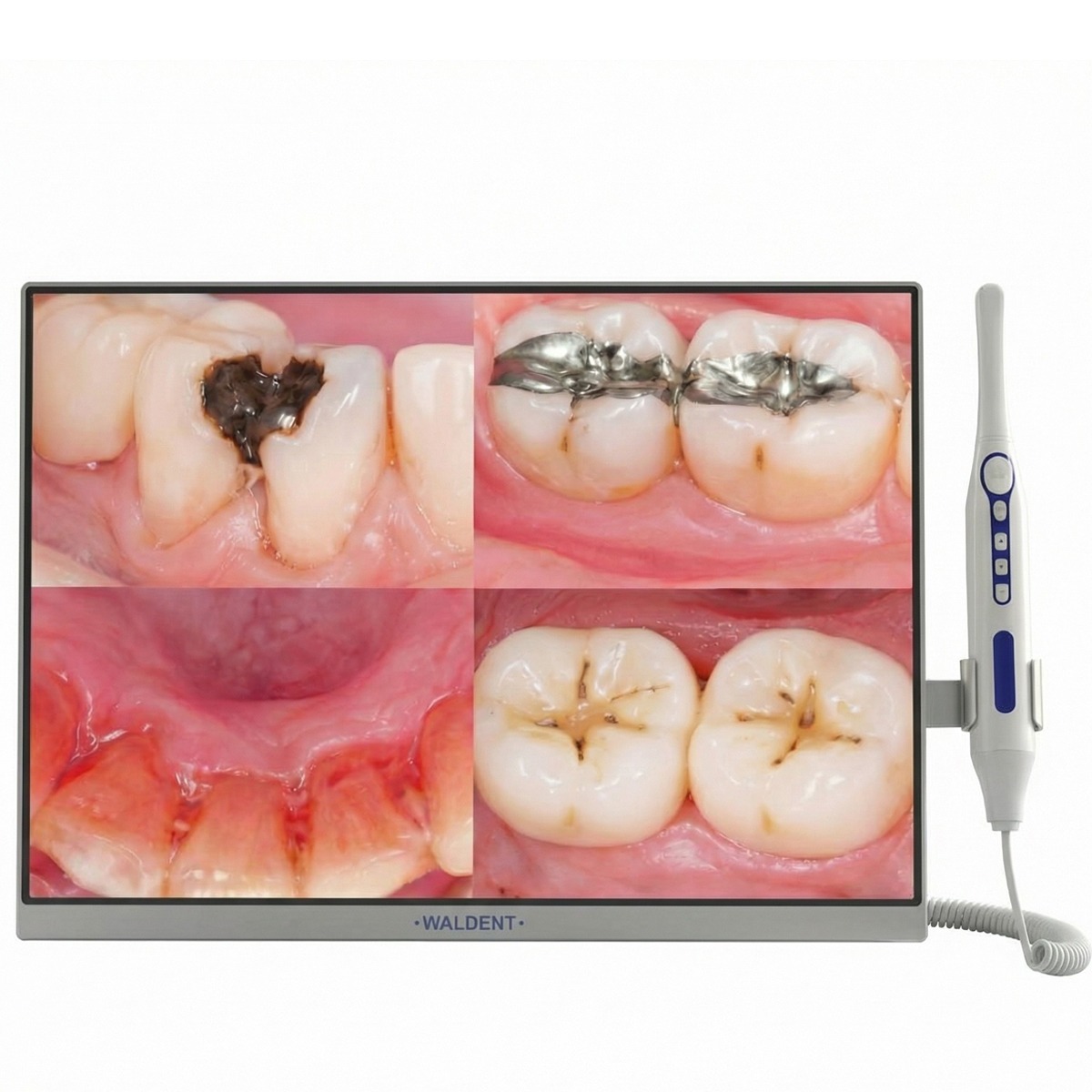 Waldent All-in-One PC Touch Screen Intraoral Camera